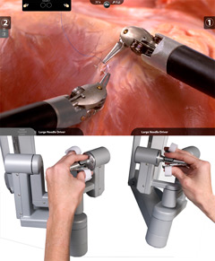 Robotic surgery